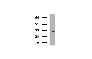 KLK8 / Kallikrein 8 Antibody - Western blot of mouse tissue lysates. (20ug) from Uterus. Primary antibody diluation: 1:500. Secondary antibody dilution: Mouse TrueBlot® Ultra. (1:1000).