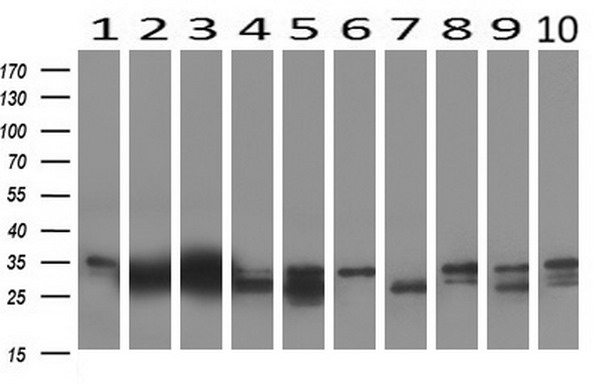 KLK8 / Kallikrein 8 Antibody - Western blot analysis of extracts. (10ug) from 10 Human tissue by using anti-KLK8 monoclonal antibody at 1:500. (1: Testis; 2: Omentum; 3: Uterus; 4: Breast; 5: Brain; 6: Liver; 7: Ovary; 8: Thyroid gland; 9: colon;10: spleen).