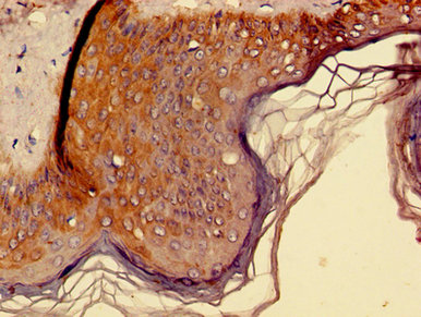 KLK8 / Kallikrein 8 Antibody - Immunohistochemistry image of paraffin-embedded human skin tissue at a dilution of 1:100