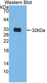 KLK9 / Kallikrein 9 Antibody - Western blot of KLK9 / Kallikrein 9 antibody.