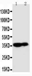 KLK9 / Kallikrein 9 Antibody - WB of KLK9 / Kallikrein 9 antibody. All lanes: Anti-KLK9 at 0.5ug/ml. Lane 1: MCF-7 Whole Cell Lysate at 40ug. Lane 2: A431 Whole Cell Lysate at 40ug. Predicted bind size: 28KD. Observed bind size: 40KD.