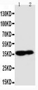 KLK9 / Kallikrein 9 Antibody - WB of KLK9 / Kallikrein 9 antibody. All lanes: Anti-KLK9 at 0.5ug/ml. Lane 1: MCF-7 Whole Cell Lysate at 40ug. Lane 2: A431 Whole Cell Lysate at 40ug. Predicted bind size: 28KD. Observed bind size: 40KD.