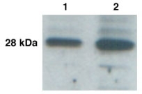 KLK9 / Kallikrein 9 Antibody - KLK L3 (KLK9) Antibody - Western Blot of KLK-L3 in cancer cell lines LnNCap(lane 1) and BT-474(lane 2) with anti-KLK-L3 at 1:1,000 dilution