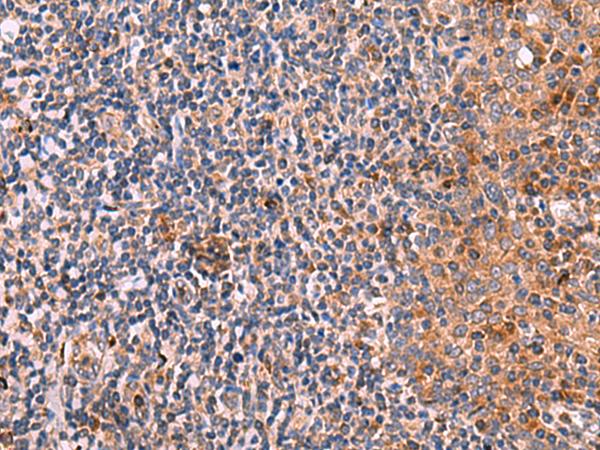 KLK9 / Kallikrein 9 Antibody - Immunohistochemistry of paraffin-embedded Human tonsil tissue  using KLK9 Polyclonal Antibody at dilution of 1:50(×200)