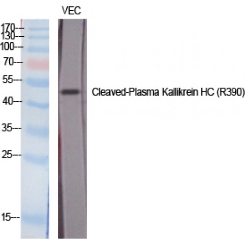 KLKB1 / Plasma Kallikrein Antibody - Western blot of Cleaved-Plasma Kallikrein HC (R390) antibody
