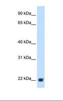 KLKB1 / Plasma Kallikrein Antibody - Fetal liver cell lysate. Antibody concentration: 2.5 ug/ml. Gel concentration: 12%.  This image was taken for the unconjugated form of this product. Other forms have not been tested.