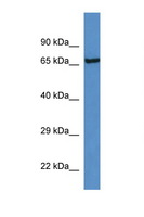 KLKB1 / Plasma Kallikrein Antibody - KLKB1 antibody Western blot of Rat Brain lysate. Antibody concentration 1 ug/ml. This image was taken for the unconjugated form of this product. Other forms have not been tested.