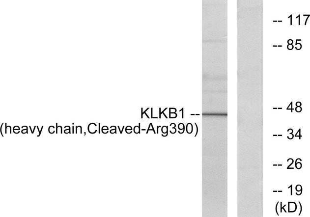 KLKB1 / Plasma Kallikrein Antibody - Western blot analysis of extracts from HeLa cells, using KLKB1 (heavy chain, Cleaved-Arg390) antibody.