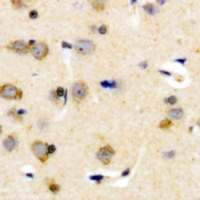 KLKB1 / Plasma Kallikrein Antibody - Immunohistochemical analysis of Plasma Kallikrein HC staining in human brain formalin fixed paraffin embedded tissue section. The section was pre-treated using heat mediated antigen retrieval with sodium citrate buffer (pH 6.0). The section was then incubated with the antibody at room temperature and detected using an HRP polymer system. DAB was used as the chromogen. The section was then counterstained with hematoxylin and mounted with DPX.