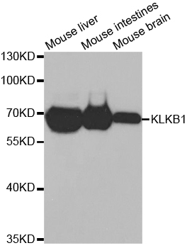 KLKB1 / Plasma Kallikrein Antibody - Western blot analysis of extracts of various cell lines, using KLKB1 antibody.