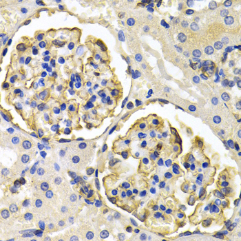KLKB1 / Plasma Kallikrein Antibody - Immunohistochemistry of paraffin-embedded rat kidney tissue.