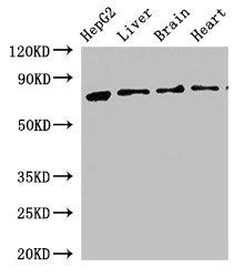 KLKB1 / Plasma Kallikrein Antibody - Western Blot Positive WB detected in: HepG2 whole cell lysate, Rat liver tissue, Rat brain tissue, Mouse heart tissue All lanes: KLKB1 antibody at 2.5µg/ml Secondary Goat polyclonal to rabbit IgG at 1/50000 dilution Predicted band size: 72 kDa Observed band size: 72 kDa