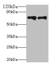 KLKB1 / Plasma Kallikrein Antibody - Western blot All lanes: Plasma kallikrein antibody at 2µg/ml Lane 1: Hela whole cell lysate Lane 2: Rat brain tissue Secondary Goat polyclonal to rabbit IgG at 1/10000 dilution Predicted band size: 71 kDa Observed band size: 71 kDa