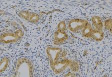 KLKB1 / Plasma Kallikrein Antibody - 1:100 staining human uterus tissue by IHC-P. The sample was formaldehyde fixed and a heat mediated antigen retrieval step in citrate buffer was performed. The sample was then blocked and incubated with the antibody for 1.5 hours at 22°C. An HRP conjugated goat anti-rabbit antibody was used as the secondary.