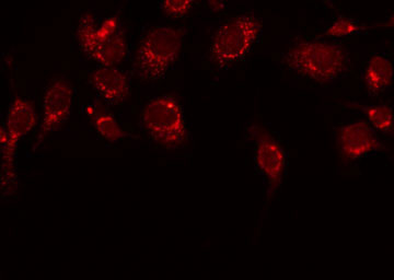 KLKB1 / Plasma Kallikrein Antibody - Staining HeLa cells by IF/ICC. The samples were fixed with PFA and permeabilized in 0.1% Triton X-100, then blocked in 10% serum for 45 min at 25°C. The primary antibody was diluted at 1:200 and incubated with the sample for 1 hour at 37°C. An Alexa Fluor 594 conjugated goat anti-rabbit IgG (H+L) Ab, diluted at 1/600, was used as the secondary antibody.