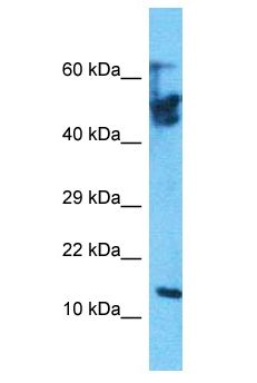 KLLN / KILLIN Antibody - KLLN / KILLIN antibody Western Blot of ACHN. Antibody dilution: 1 ug/ml.  This image was taken for the unconjugated form of this product. Other forms have not been tested.