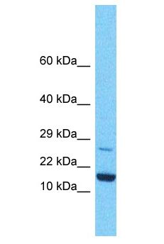 KLLN / KILLIN Antibody - KLLN / KILLIN antibody Western Blot of HeLa. Antibody dilution: 1 ug/ml.  This image was taken for the unconjugated form of this product. Other forms have not been tested.