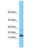 KLLN / KILLIN Antibody - KLLN / KILLIN antibody Western Blot of HeLa. Antibody dilution: 1 ug/ml.  This image was taken for the unconjugated form of this product. Other forms have not been tested.