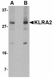 Klra2 Antibody - Western blot of KLRA2 in mouse spleen tissue lysate with KLRA2 antibody at (A) 0.5 and (B) 1 ug/ml.