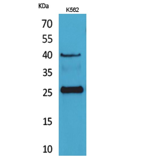 KLRB1 / CD161 Antibody - Western blot of CD161 antibody