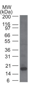 KLRB1 / CD161 Antibody - Western Blot: CD161 Antibody (14F1F11) - Western blot analysis of a partial CD161 recombinant protein using CD161 antibody at 1 ug/ml.  This image was taken for the unconjugated form of this product. Other forms have not been tested.