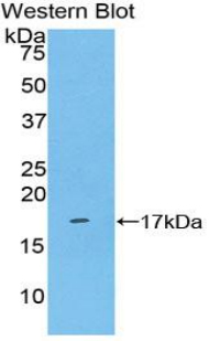 KLRB1 / CD161 Antibody - Western blot of recombinant KLRB1 / CD161.  This image was taken for the unconjugated form of this product. Other forms have not been tested.