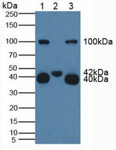 KLRB1 / CD161 Antibody - Western Blot; Lane1: Human 293T Cells; Lane2: Porcine Muscle Tissue; Lane3: Porcine Spleen Tissue