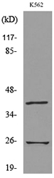 KLRB1 / CD161 Antibody - Western blot analysis of lysate from K562 cells, using KLRB1 Antibody.