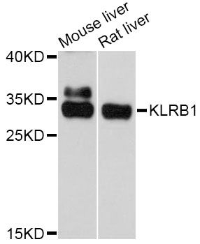 KLRB1 / CD161 Antibody - Western blot analysis of extracts of various cell lines, using KLRB1 antibody at 1:3000 dilution. The secondary antibody used was an HRP Goat Anti-Rabbit IgG (H+L) at 1:10000 dilution. Lysates were loaded 25ug per lane and 3% nonfat dry milk in TBST was used for blocking. An ECL Kit was used for detection and the exposure time was 90s.