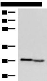 KLRB1 / CD161 Antibody - Western blot analysis of Human fetal intestines tissue and Human fetal liver tissue lysates  using KLRB1 Polyclonal Antibody at dilution of 1:800