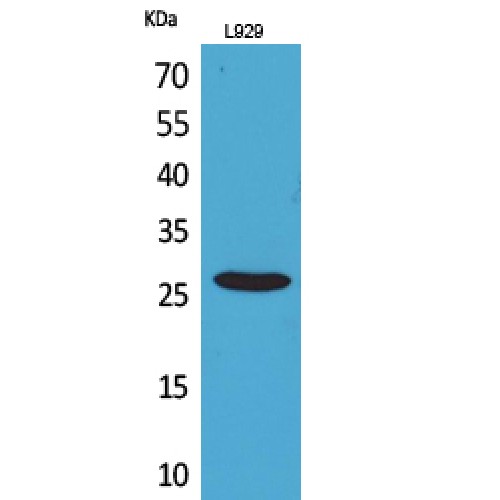 KLRC1 + KLRC2 Antibody - Western blot of CD159a/c antibody