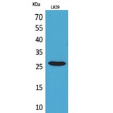 KLRC1 + KLRC2 Antibody - Western blot of CD159a/c antibody