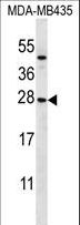KLRC1 / NKG2A / CD159a Antibody - KLRC1 Antibody western blot of MDA-MB435 cell line lysates (35 ug/lane). The KLRC1 antibody detected the KLRC1 protein (arrow).
