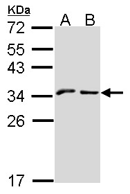 KLRC1 / NKG2A / CD159a Antibody - Sample (30 ug of whole cell lysate). A: A431 , B: Hep G2 . 12% SDS PAGE. NKG2-A (CD159a) antibody. NKG2A antibody diluted at 1:1000.