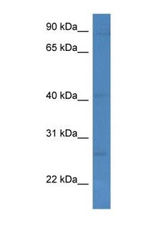 KLRC1 / NKG2A / CD159a Antibody - KLRC1 / NKG2A antibody Western blot of MCF7 Cell lysate. Antibody concentration 1 ug/ml.  This image was taken for the unconjugated form of this product. Other forms have not been tested.