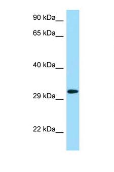 KLRC1 / NKG2A / CD159a Antibody - KLRC1 / NKG2A antibody Western blot of 293T Cell lysate. Antibody concentration 1 ug/ml.  This image was taken for the unconjugated form of this product. Other forms have not been tested.