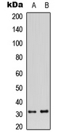 KLRC1 / NKG2A / CD159a Antibody - Western blot analysis of CD159a expression in HeLa (A); SHSY5Y (B) whole cell lysates.