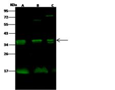KLRC1 / NKG2A / CD159a Antibody - Anti-KLRC1 rabbit polyclonal antibody at 1:500 dilution. Lane A: Jurkat Whole Cell Lysate. Lane B: A431 Whole Cell Lysate. Lane C: K562 Whole Cell Lysate. Lysates/proteins at 30 ug per lane. Secondary: Goat Anti-Rabbit IgG H&L (Dylight 800) at 1/10000 dilution. Developed using the Odyssey technique. Performed under reducing conditions. Predicted band size: 26 kDa. Observed band size: 36 kDa. (We are unsure as to the identity of these extra bands.)