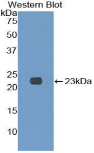 KLRC2 / NKG2C / CD159c Antibody - Western blot of recombinant KLRC2 / NKG2C.  This image was taken for the unconjugated form of this product. Other forms have not been tested.