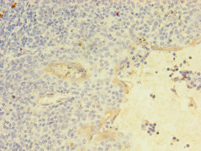KLRC2 / NKG2C / CD159c Antibody - Immunohistochemistry of paraffin-embedded human tonsil tissue using KLRC2 Antibody at dilution of 1:100
