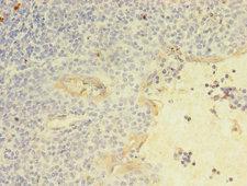 KLRC2 / NKG2C / CD159c Antibody - Immunohistochemistry of paraffin-embedded human tonsil tissue using KLRC2 Antibody at dilution of 1:100