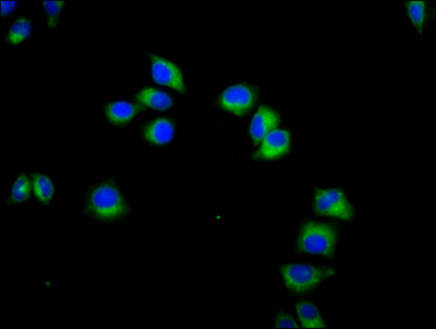 KLRC3 / NKG2E Antibody - Immunofluorescence staining of Hela cells diluted at 1:133, counter-stained with DAPI. The cells were fixed in 4% formaldehyde, permeabilized using 0.2% Triton X-100 and blocked in 10% normal Goat Serum. The cells were then incubated with the antibody overnight at 4°C.The Secondary antibody was Alexa Fluor 488-congugated AffiniPure Goat Anti-Rabbit IgG (H+L).