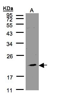 KLRC4 Antibody - Sample (30 ug of whole cell lysate). A:293T. 12% SDS PAGE. KLRC4 antibody diluted at 1:1000