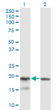 KLRC4 Antibody - Western Blot analysis of KLRC4 expression in transfected 293T cell line by KLRC4 monoclonal antibody (M03), clone 1D10.Lane 1: KLRC4 transfected lysate(18.2 KDa).Lane 2: Non-transfected lysate.