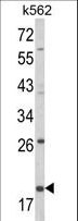 KLRD1 / CD94 Antibody - Western blot of KLRD1 Antibody in K562 cell line lysates (35 ug/lane). KLRD1 (arrow) was detected using the purified antibody.