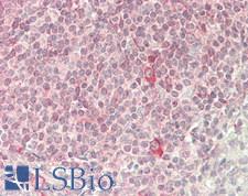 KLRD1 / CD94 Antibody - Human Spleen: Formalin-Fixed, Paraffin-Embedded (FFPE)