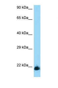 KLRD1 / CD94 Antibody - KLRD1 / CD94 antibody western blot of A549 Cell lysate. Antibody concentration 1 ug/ml.  This image was taken for the unconjugated form of this product. Other forms have not been tested.