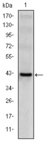 KLRD1 / CD94 Antibody - Western blot using CD94 monoclonal antibody against human CD94 (AA: 32-179) recombinant protein. (Expected MW is 42.6 kDa)