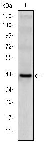 KLRD1 / CD94 Antibody - CD94 Antibody in Western Blot (WB)