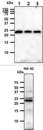 KLRD1 / CD94 Antibody - The cell lysates (40ug) were resolved by SDS-PAGE, transferred to PVDF membrane and probed with anti-human KLRD1 antibody (1:1000). Proteins were visualized using a goat anti-mouse secondary antibody conjugated to HRP and an ECL detection system. Lane 1.: K562 cell lysate Lane 2.: MCF7 cell lysate Lane 3.: A549 cell lysate The NK-92 cell lysates (40ug) were resolved by SDS-PAGE, transferred to PVDF membrane and probed with anti-human KLRD1 antibody (1:1000). Proteins were visualized using a goat anti-mouse secondary antibody conjugated to HRP and an ECL detection system.